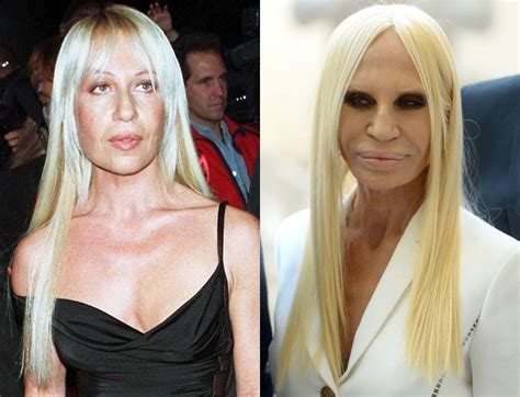 donatella versace in versace|donatella versace before and after.